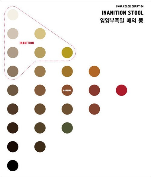 똥색깔로 보는 건강상태 | 인스티즈