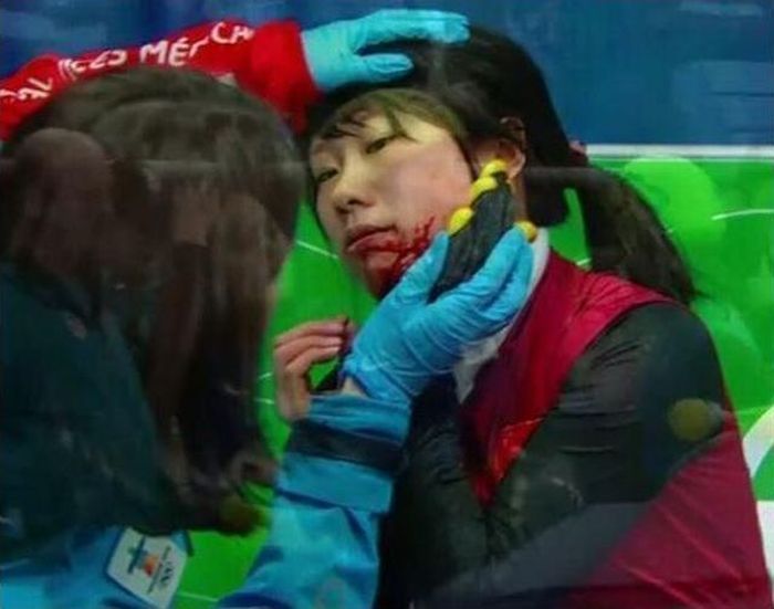 디진다 이미지