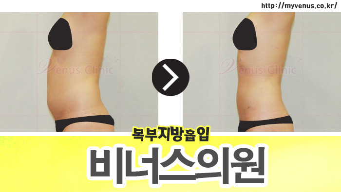 비너스의원 이미지