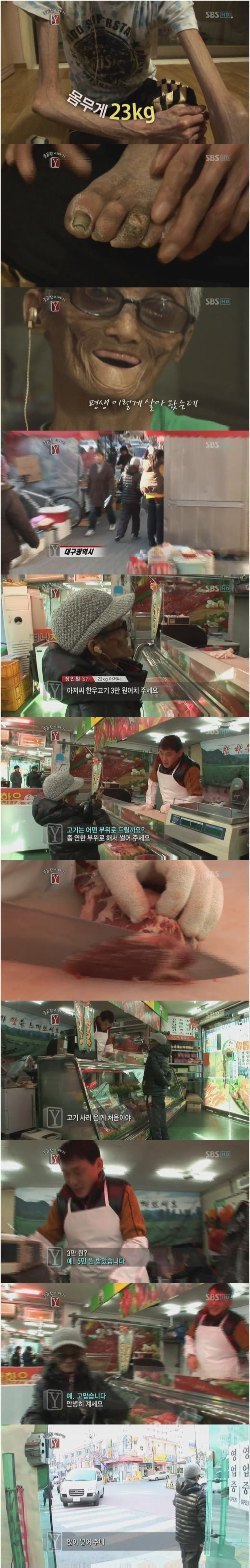 23kg 조로증 할아버지 그 후 이야기.jpg | 인스티즈
