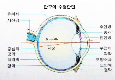 라식 라섹 부작용 후기들 | 인스티즈