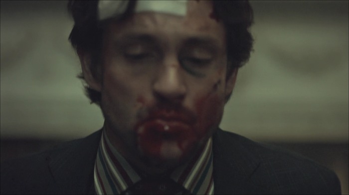 [로맨틱스릴러미드] 한니발 (Hannibal) 시즌3 에피7 (2/4) | 인스티즈