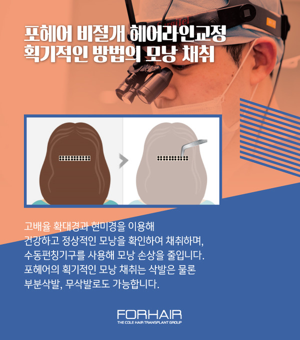 미미헤어라인 이미지