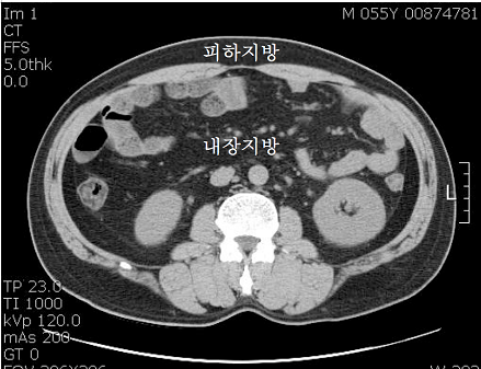 침묵의 암살자 뱃속의 시한폭탄 내장지방의 위험성 | 인스티즈
