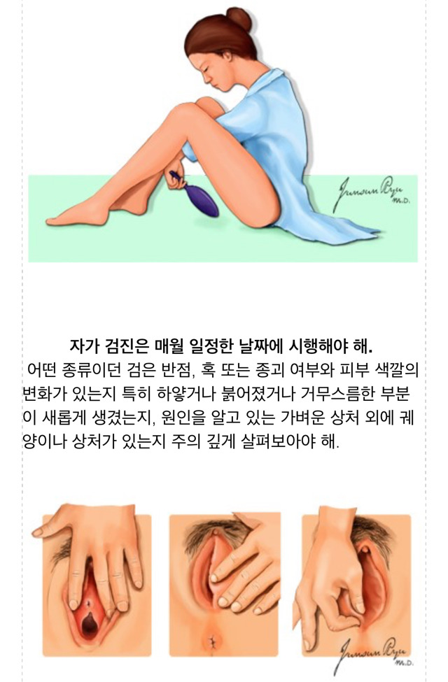 내 생식기 자가검진은 어떻게 해요? (여성 필독) (그림 있음) | 인스티즈