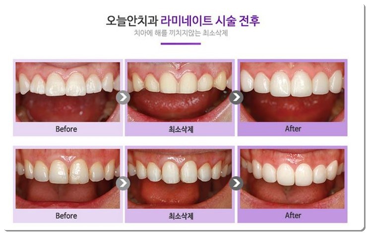 오늘의치과 이미지