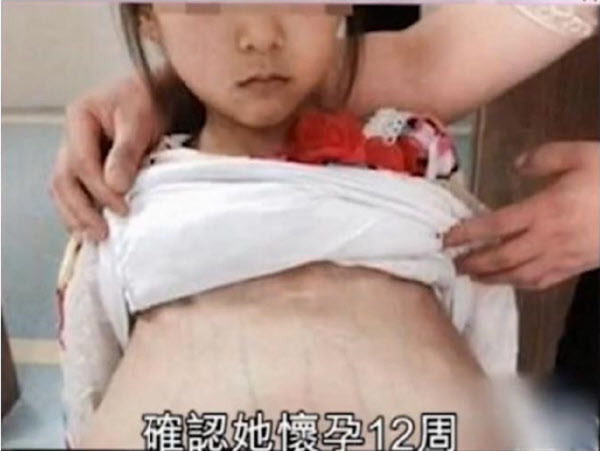 12살 소녀 임신시키고 병원에 가서 20살 된 아내라고 속인 중국남자 | 인스티즈