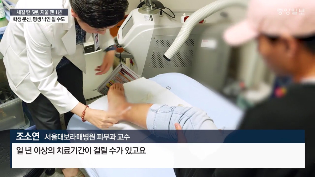 문신하고 후회하는 10대들 | 인스티즈