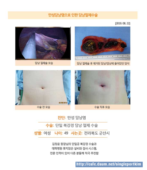 만성설비 이미지