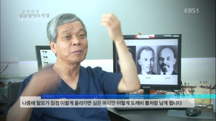 모발이식수술의 이면 | 인스티즈