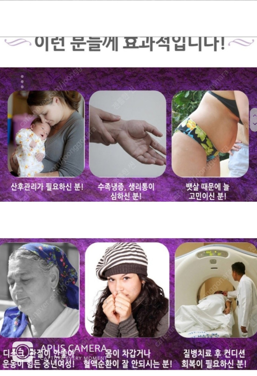 바이오포톤 이미지